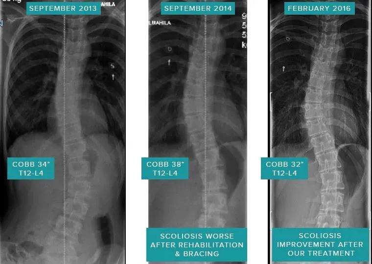 sps鍒涘浜虹悊鏌ュ痉,鐞嗘煡寰蜂翰鎺坰ps瀵煎笀