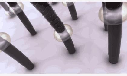 洗发水油头救星去屑止痒,油头救星澳洲茶树洗发水