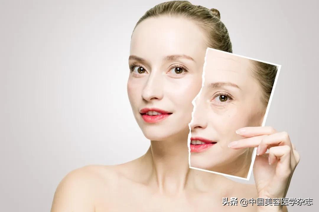 皮肤激光治疗的副作用,激光治疗皮肤松弛有效吗