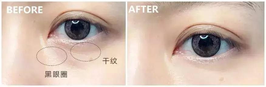 护肤太多的坏处有哪些呢,护肤越补越糟糕