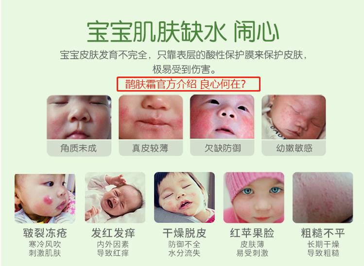 宝宝霜含激素的名单,宝宝抑菌霜激素超标