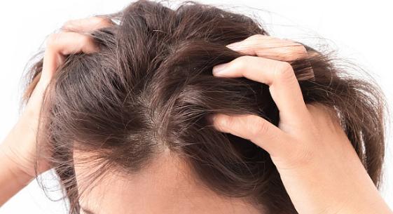 掌握这四点轻松拥有领导力,分享一下去屑经验