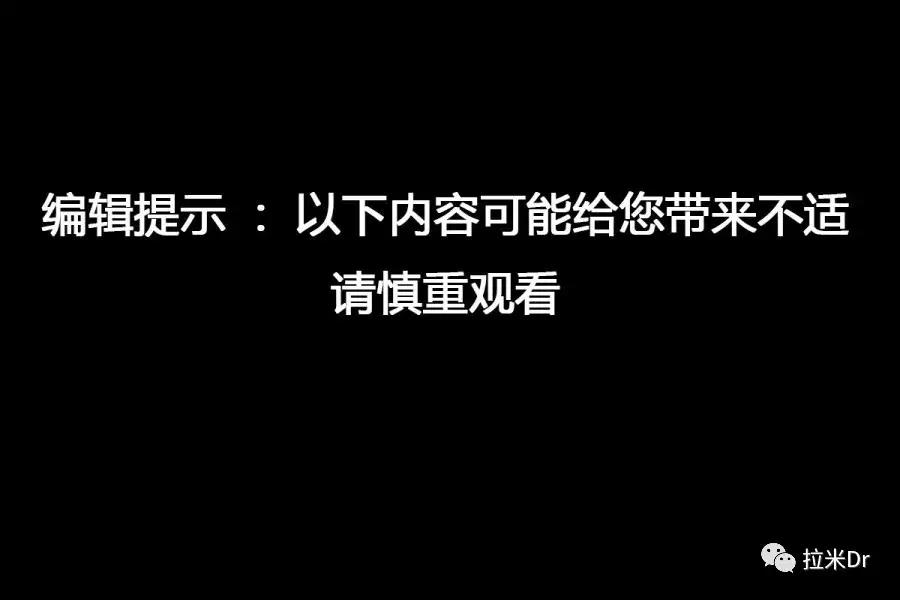 脱屑跟鳞屑是一个意思么,脱屑和脱皮的区别