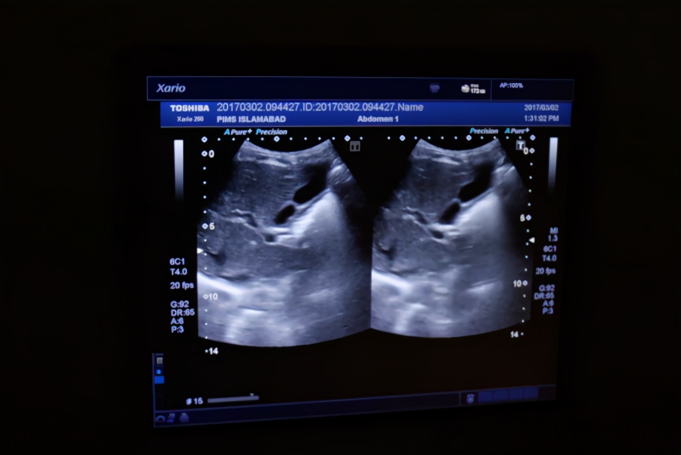 太阳能男孩完整版,太阳能男孩现状