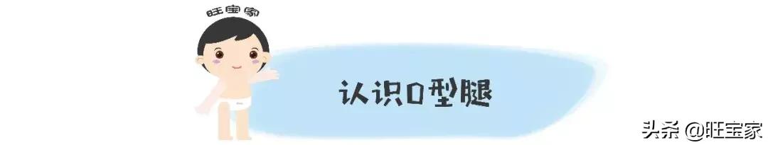 林允儿的o型腿,林允儿的o型腿走路