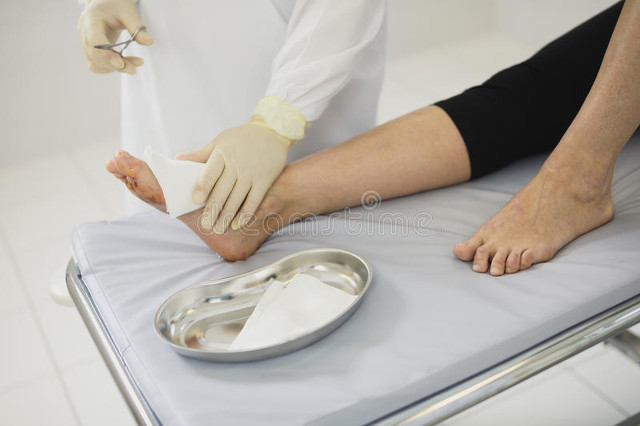 皮肤手术疤痕去除,面部疤痕去除手术