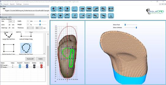 权健的矫正鞋垫的危害,权健正骨鞋垫功效