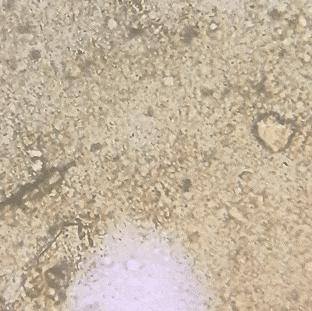 显微镜下的猫屎，竟然和这么多食物都撞脸？