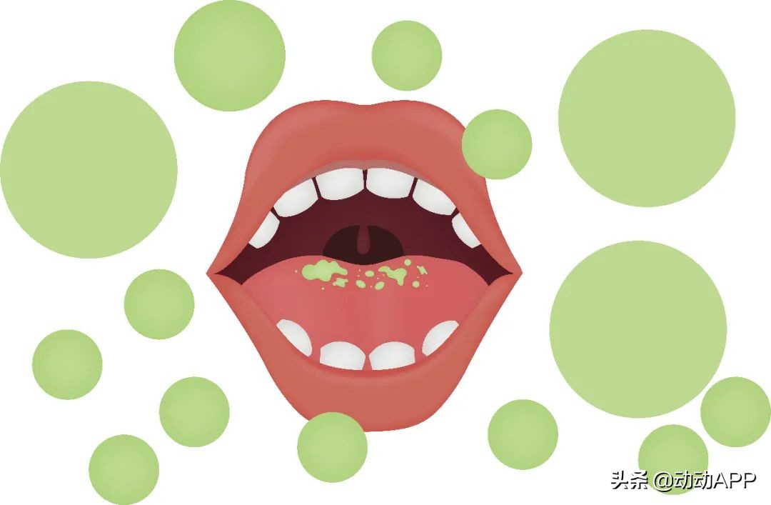 口罩戴一会有臭味是口臭导致的吗,口臭自己戴口罩闻不到怎么回事