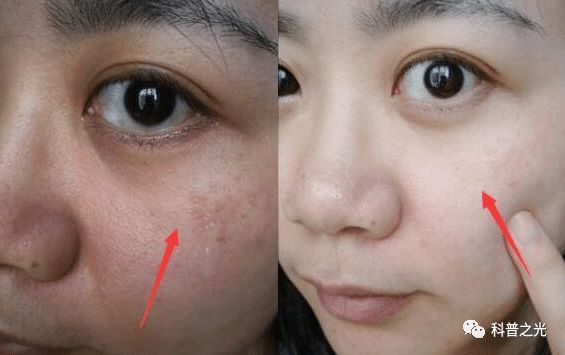 药店白色药膏,药店的乳膏有哪些