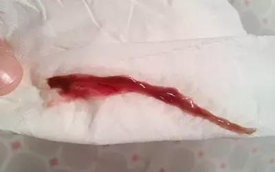 裤腰带老是掉出来咋办,裤子里老是粘东西怎么办