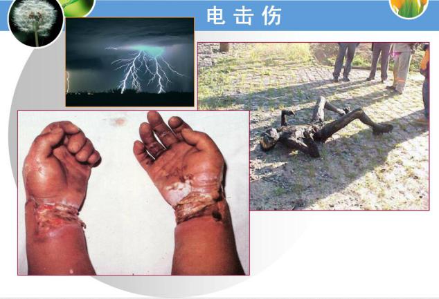 电击伤的急救护理措施有哪些,电击伤的院前急救及预防