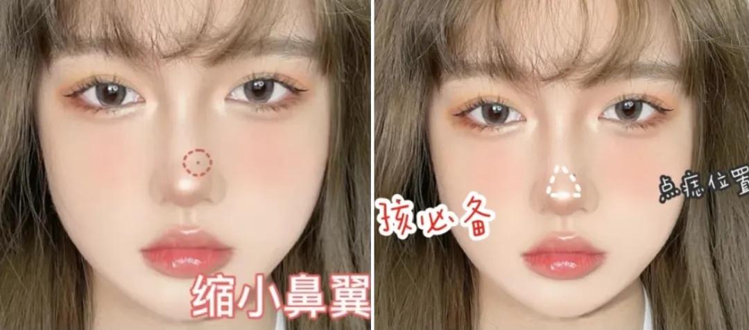 点痣就能变美,点痣整容大法