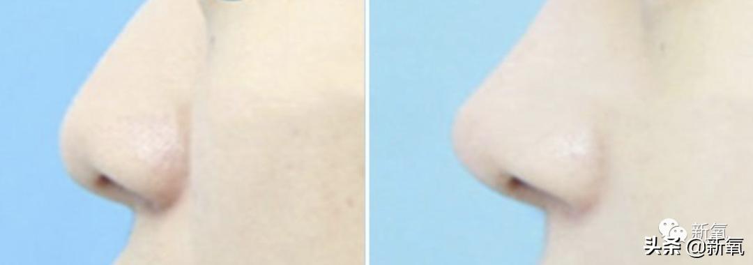 杨超越还能撑多久,杨超越遇到的真实事件