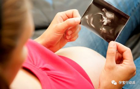 胎盘钙化与吃钙有关吗,胎盘钙化是摄入的钙太多了吗