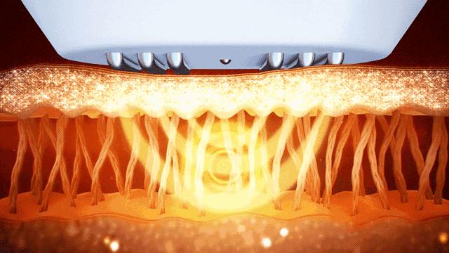 热拉提抗衰,抗衰老的杀手锏热拉提plus