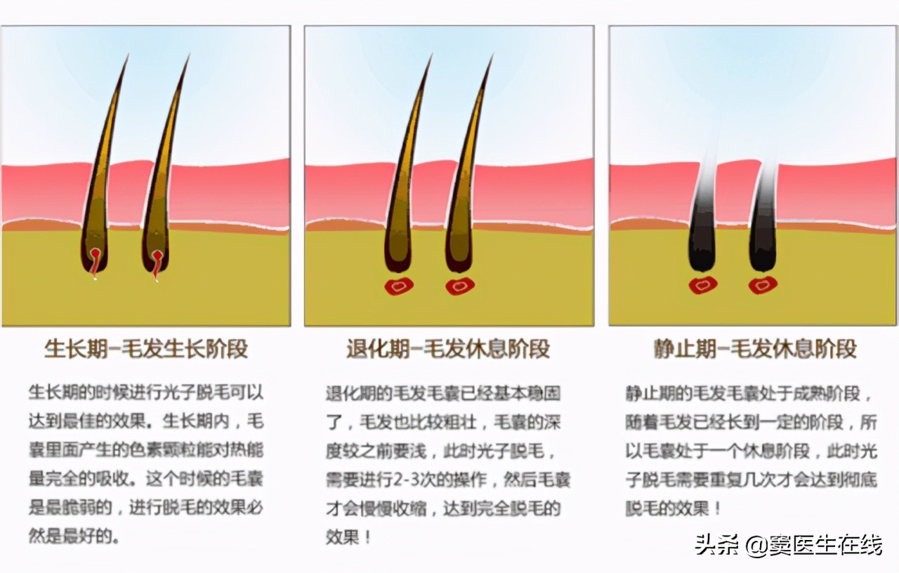 体毛要不要刮掉要一直处理吗,体毛刮掉对身体有什么影响