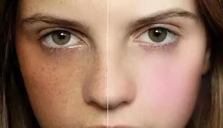 谁说女人过了三十就是黄脸婆,黄脸婆用什么护肤品最好