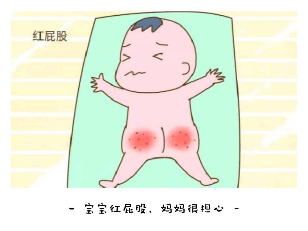 宝宝红屁股，家长这样做就能轻松避免