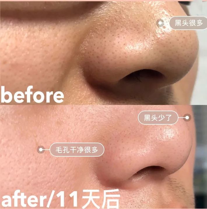 一块驴奶皂搞定洁面、卸妆，还能洗澡去鸡皮！我要回购10000次