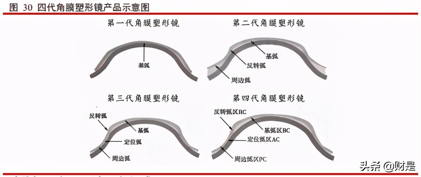 爱博医疗眼科器械上市,眼科行业研究报告