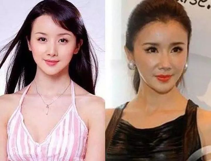 整成网红脸,为什么明星喜欢整成网红脸