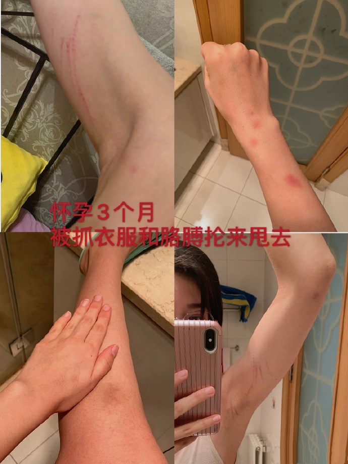 张培萌被控诉家暴,张培萌妻子回应家暴