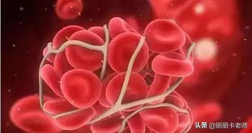 深海鱼油破了特别腥气怎么处理,深海鱼油可以调理血液粘稠吗