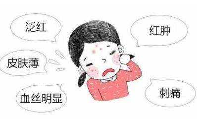 脸上有红血丝怎么修复小窍门,脸上红血丝怎么修复最好有效