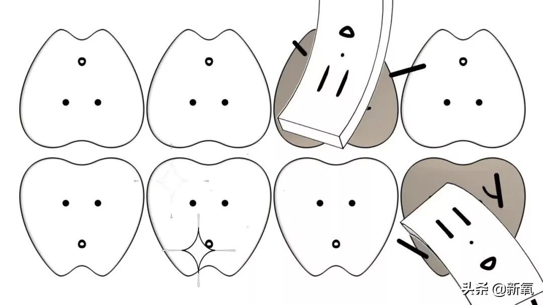 宋祖儿牙齿是烤瓷牙吗,宋祖儿牙齿
