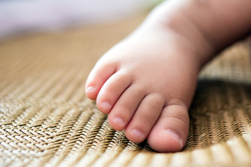 夏天睡凉席有红点,夏季凉席易诱发皮炎