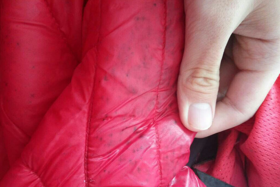 衣服上发霉了怎么处理，白醋跟牛奶可以处理，樟脑丸可以预防