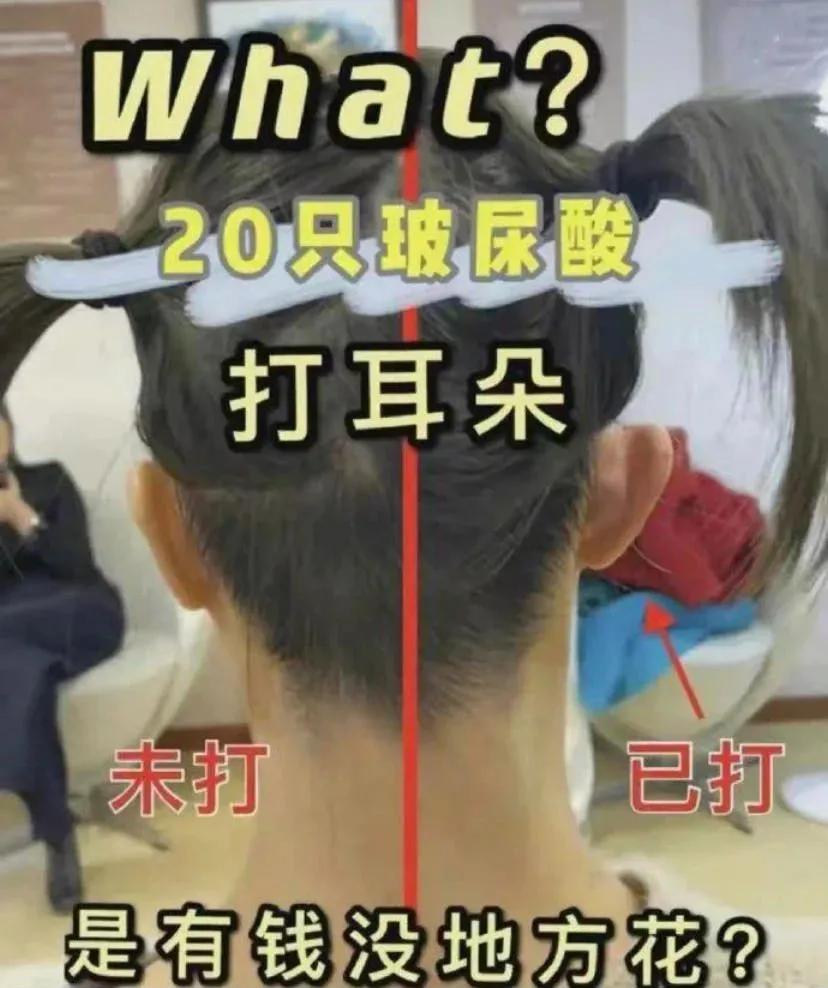 小腿阻断针,小腿阻断