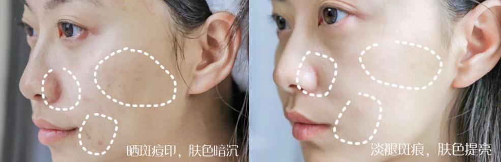 韩束消细纹,韩束洗白肌面奶