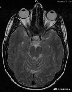 放射科趣味图片,放射科亮点图片