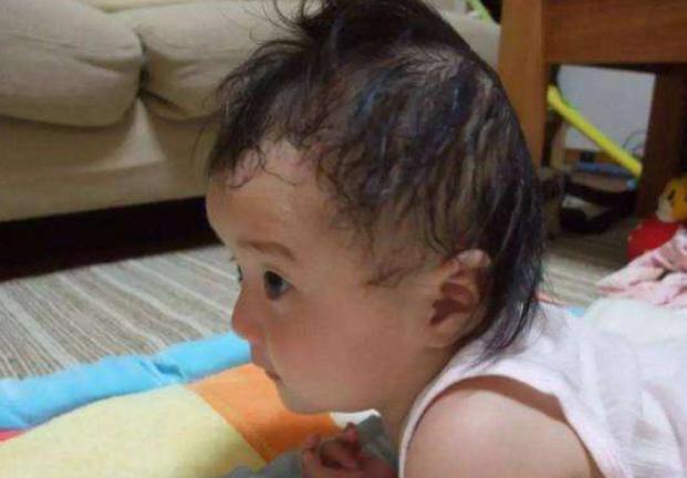 小孩积食上火咳嗽怎么快速消食,小孩积食咳嗽吃什么能快速消食