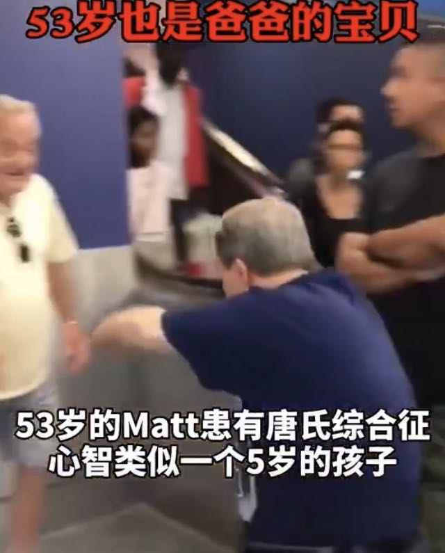 唐氏胎儿眼距一般多宽,唐氏胎儿眼距都宽吗