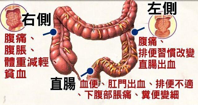 癌症辟谣,肿瘤患者辟谣