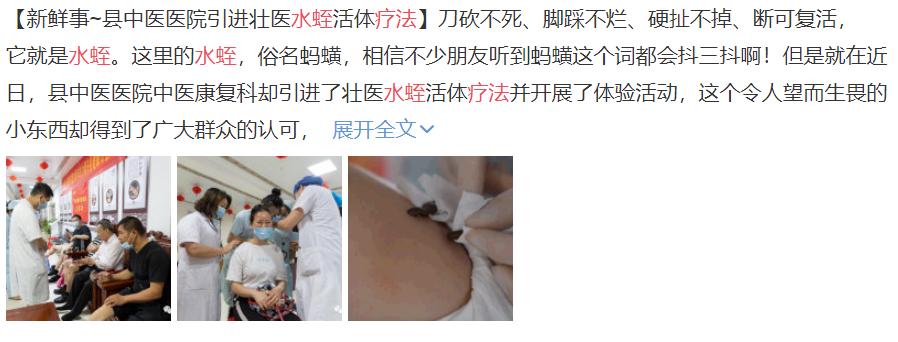 水蛭,从古到今它都是医生的帮手......