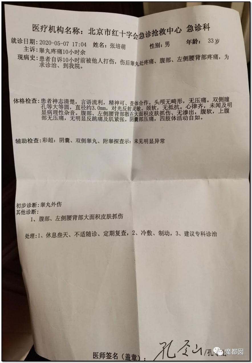 短跑名将张培萌家暴事件,短跑名将张培萌殴打岳母视频