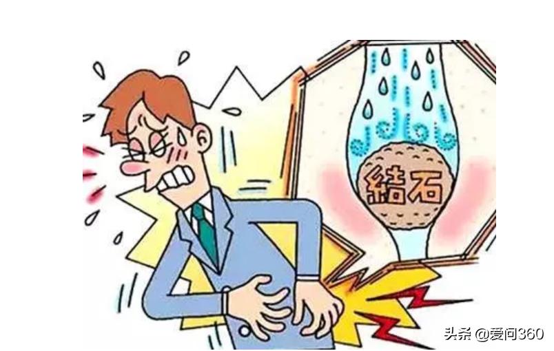 肾结石通常是什么原因造成的,肾结石是怎么形成的有什么方法