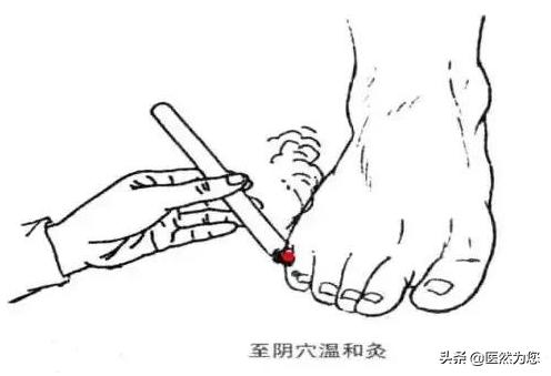 孕期总担心胎儿不健康怎么办,孕妇胎位不正医生纠正标准动作