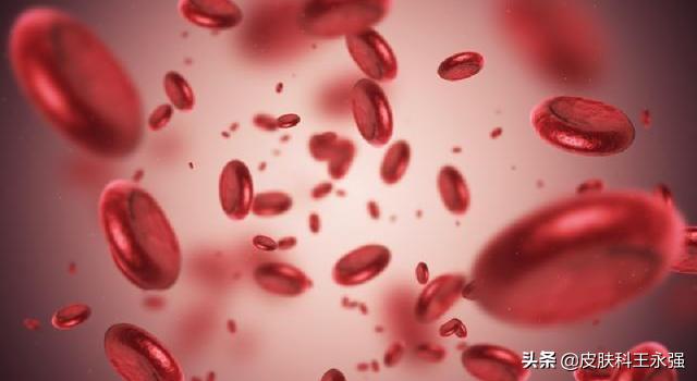 慢性萎缩性胃炎贫血原因,萎缩性胃炎贫血是缺铁性贫血吗