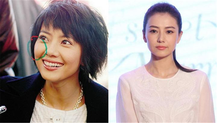 改善颧骨的10个方法,颧骨美学