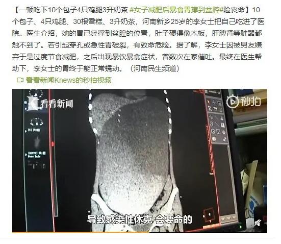 漏尿与内脏下垂,漏尿先天畸形