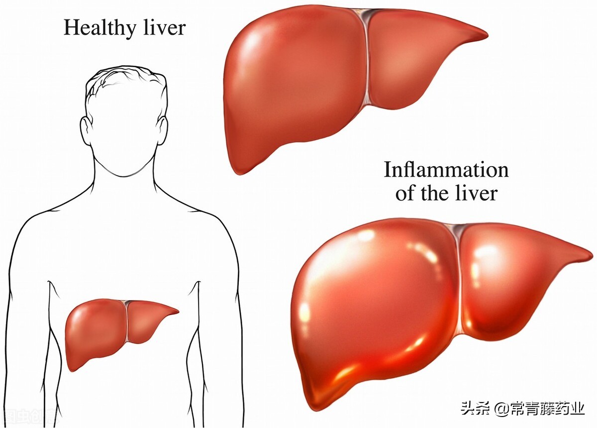甲胎蛋白afp属于什么检查,甲胎蛋白afp是检查什么病