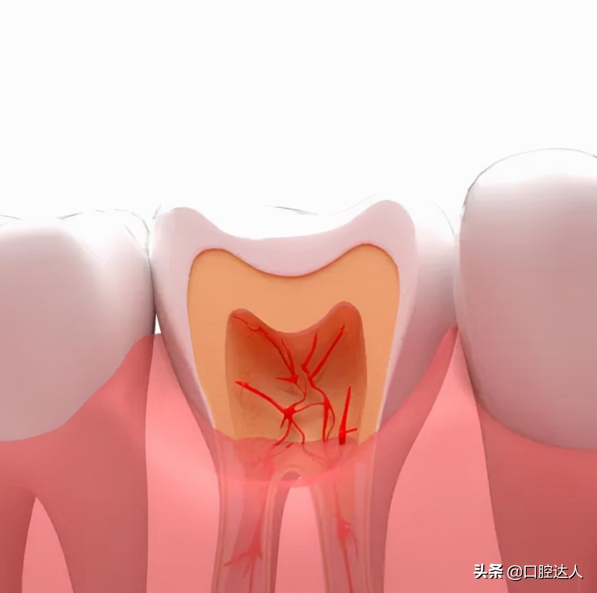 怀孕牙疼的晚上睡不着怎么缓解,牙疼睡不着怎么缓解快速入睡