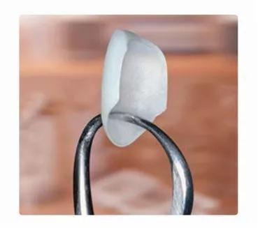 牙冠修复和牙齿贴面哪个比较好,修复牙齿应该先洗牙还是先补牙