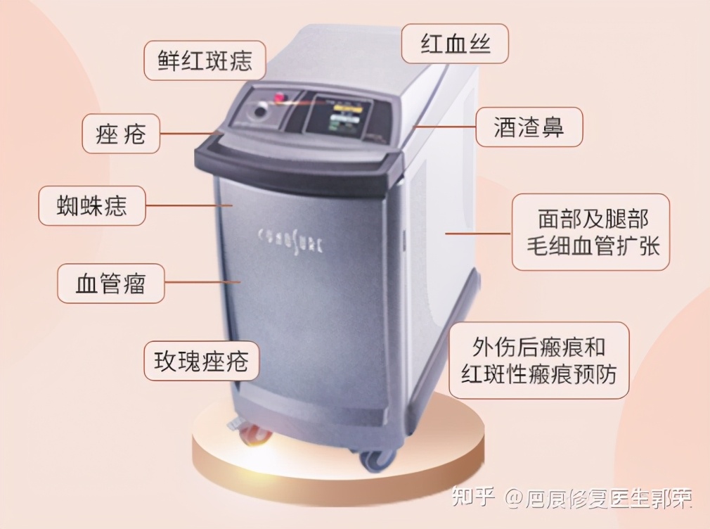 cynergy激光治疗仪副作用,cynergy双波长血管激光