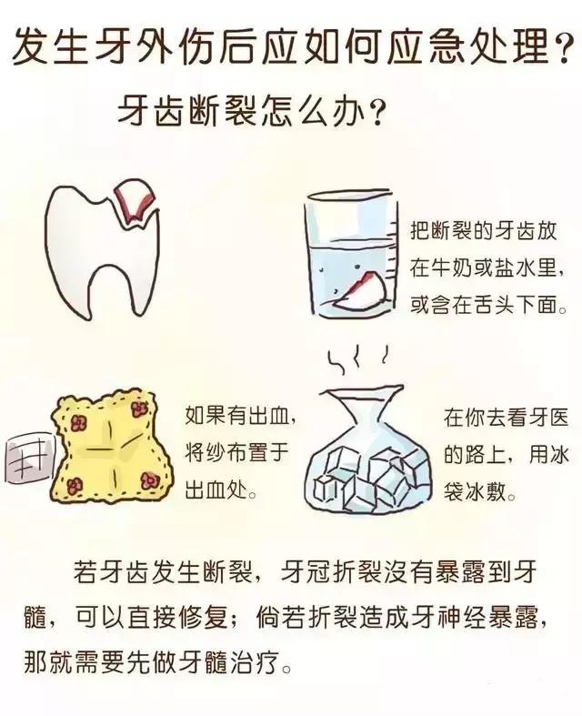 儿童摔断牙齿怎么治疗,孩子摔断门牙后该如何处理